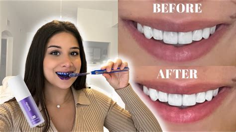 How Does Purple Toothpaste Whiten Teeth .